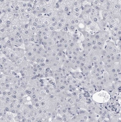 Immunohistochemistry-Paraffin: Myocilin Antibody [NBP1-89769]