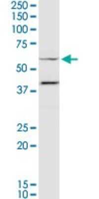 Western Blot: Myocilin Antibody [H00004653-D01P]