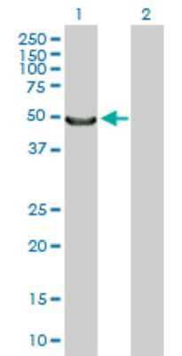 Western Blot: Myocilin Antibody [H00004653-D01P]