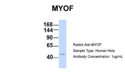 Western Blot: Myoferlin Antibody [NBP1-59396]