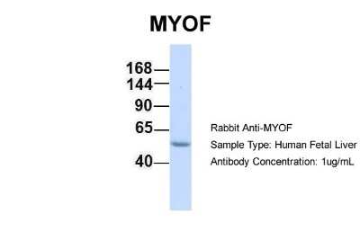 Western Blot: Myoferlin Antibody [NBP1-59396]
