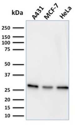 Western Blot: Myofibroblast Marker Antibody (PR 2D3) [NBP3-07745]