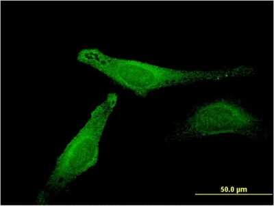 Immunocytochemistry/ Immunofluorescence: Myoglobin Antibody (4F8) [H00004151-M13]