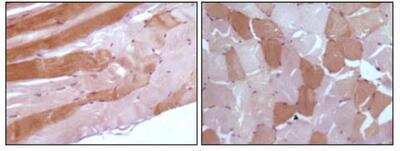 Immunohistochemistry-Paraffin: Myoglobin Antibody (5A2G8) - BSA Free [NB110-89456]
