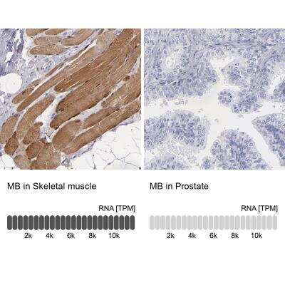Immunohistochemistry-Paraffin: Myoglobin Antibody [NBP2-54897]