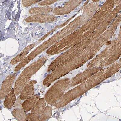 Immunohistochemistry-Paraffin: Myoglobin Antibody [NBP2-54897]