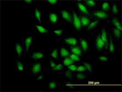Immunocytochemistry/ Immunofluorescence: Myomegalin Antibody (2B5) [H00009659-M01]