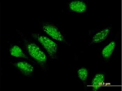 Immunocytochemistry/ Immunofluorescence: Myomegalin Antibody [H00009659-B01P]
