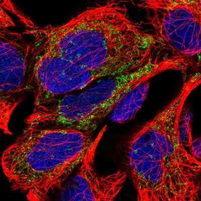 Immunocytochemistry/ Immunofluorescence: Myomesin 2 Antibody [NBP1-87496]