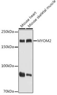 Western Blot: Myomesin 2 AntibodyAzide and BSA Free [NBP3-16037]
