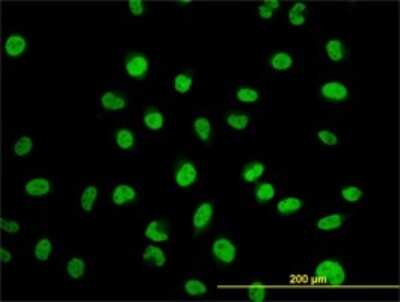 Immunocytochemistry/ Immunofluorescence: Myoneurin Antibody (3E8) [H00055892-M01]