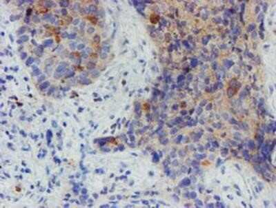 Immunohistochemistry: Myoneurin Antibody (OTI1F10) - Azide and BSA Free [NBP2-72863]