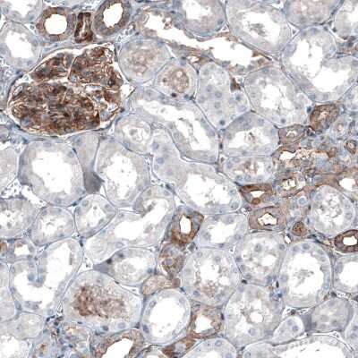 Immunohistochemistry-Paraffin: Myosin 1B Antibody [NBP1-87739]