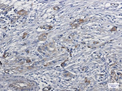 Immunohistochemistry-Paraffin: Myosin 1B Antibody (S04-6D4) [NBP3-19708]