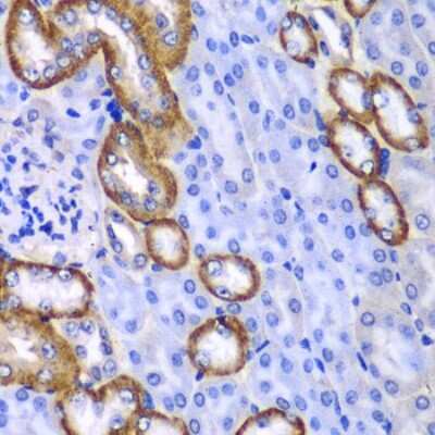 Immunohistochemistry-Paraffin: Myosin 1C Antibody - BSA Free [NBP2-95224]