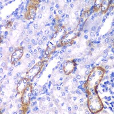 Western Blot: Myosin 1C AntibodyBSA Free [NBP2-95224]