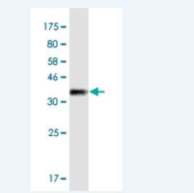 Western Blot: Myosin 1E Antibody (7A5) [H00004643-M02-100ug]