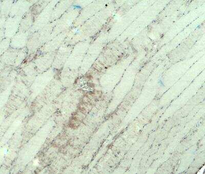 Immunohistochemistry: Myosin Heavy Chain 3 Antibody - BSA Free [NBP2-81968]