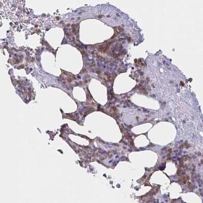 Immunohistochemistry: Myosin IF Antibody [NBP2-31598]