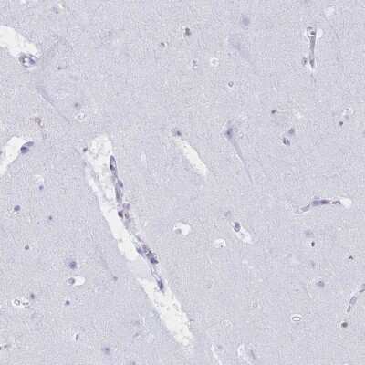 Immunohistochemistry-Paraffin: Myosin IF Antibody [NBP2-31598]