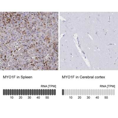 Immunohistochemistry-Paraffin: Myosin IF Antibody [NBP2-31598]
