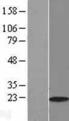 Western Blot: Myosin Light Chain 2 Overexpression Lysate [NBL1-13424]