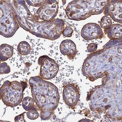 Immunohistochemistry-Paraffin: Myosin VB Antibody [NBP1-87746]