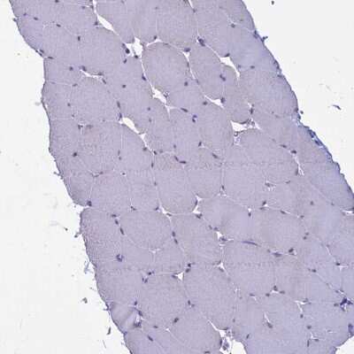 Immunohistochemistry-Paraffin: Myosin VB Antibody [NBP1-87746]