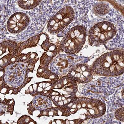 Immunohistochemistry-Paraffin: Myosin VB Antibody [NBP1-87746]