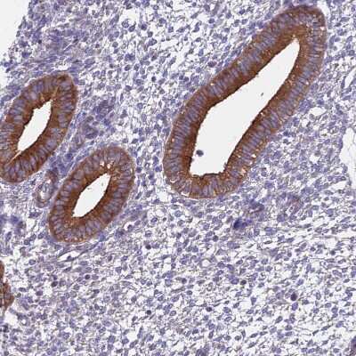 Immunohistochemistry-Paraffin: Myosin VB Antibody [NBP1-87746]