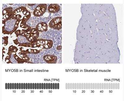 Immunohistochemistry-Paraffin: Myosin VB Antibody [NBP1-87747]