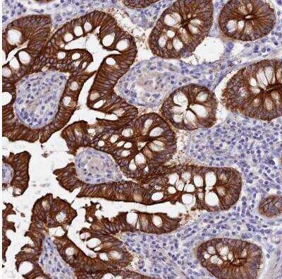 Immunohistochemistry-Paraffin: Myosin VB Antibody [NBP1-87747]