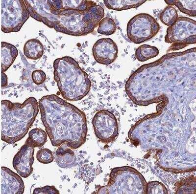 Immunohistochemistry-Paraffin: Myosin VB Antibody [NBP1-87747]