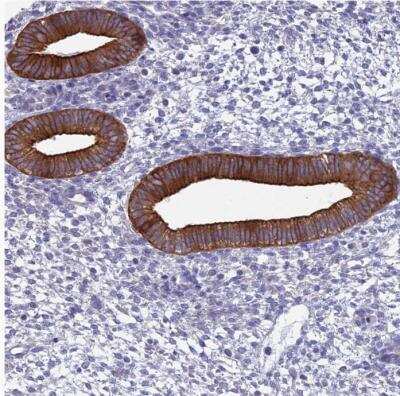 Immunohistochemistry-Paraffin: Myosin VB Antibody [NBP1-87747]
