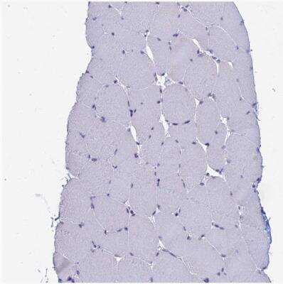 Immunohistochemistry-Paraffin: Myosin VB Antibody [NBP1-87747]