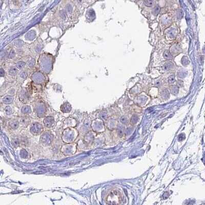 Immunohistochemistry-Paraffin: Myosin VB Antibody [NBP1-87747]