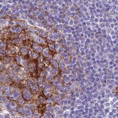 Immunohistochemistry-Paraffin: Myosin VB Antibody [NBP1-87747]