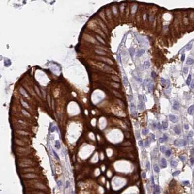Immunohistochemistry-Paraffin: Myosin VB Antibody [NBP1-87747]
