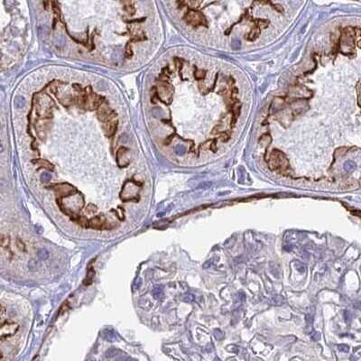 Immunohistochemistry-Paraffin: Myosin VB Antibody [NBP1-87747]