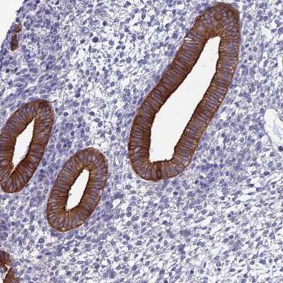 Immunohistochemistry-Paraffin: Myosin VB Antibody [NBP1-87747]