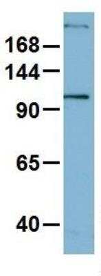 Western Blot: Myosin Heavy Chain 1 Antibody [NBP1-57681]