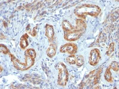 Immunohistochemistry-Paraffin: Myosin heavy chain 11 Antibody (ID8) [NBP2-44532]