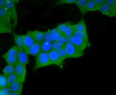 Immunocytochemistry/ Immunofluorescence: Myosin heavy chain 11 Antibody (JA03-35) [NBP2-66967]