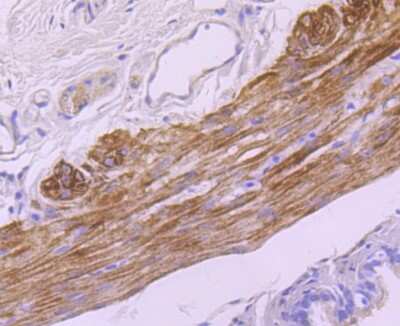Immunohistochemistry-Paraffin: Myosin heavy chain 11 Antibody (JA03-35) [NBP2-66967]
