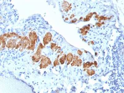 Immunohistochemistry-Paraffin: Myosin heavy chain 11 Antibody (MYH11/2303R) [NBP3-07595]