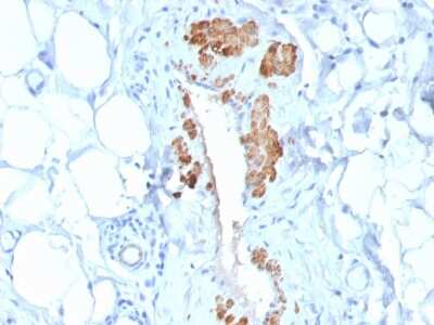 Immunohistochemistry-Paraffin: Myosin heavy chain 11 Antibody (MYH11/2303R) [NBP3-07595]