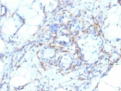 Immunohistochemistry-Paraffin: Myosin heavy chain 11 Antibody (MYH11/923 + SMMS-1) [NBP2-44534]