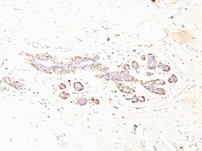 Immunohistochemistry-Paraffin: Myosin heavy chain 11 Antibody (MYH11/923 + SMMS-1) [NBP2-44534]