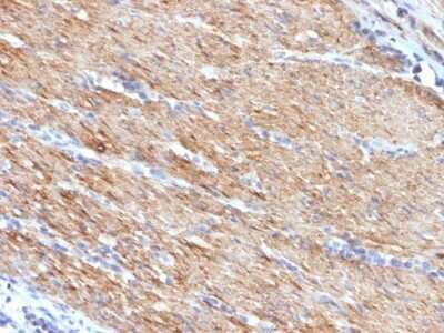 Immunohistochemistry-Paraffin: Myosin heavy chain 11 Antibody (MYH11/923) - Azide and BSA Free [NBP2-47900]
