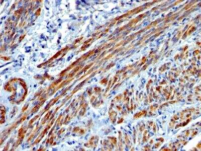 Immunohistochemistry-Paraffin: Myosin heavy chain 11 Antibody (MYH11/923) - IHC-Prediluted [NBP2-48149]